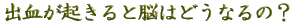 NSTとは