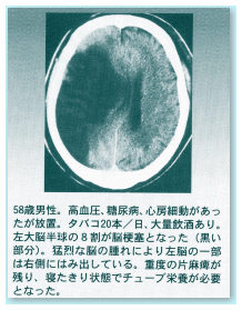 恵三 死因 小渕